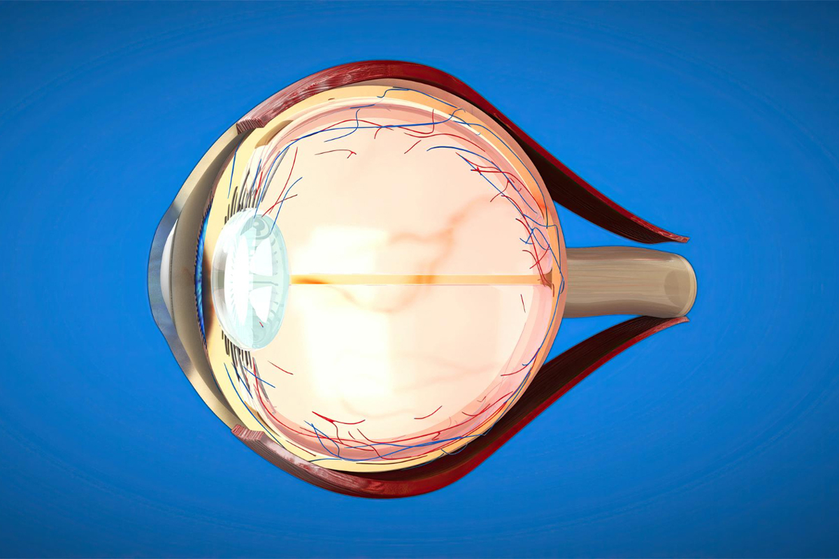 freepik_cataract_0326