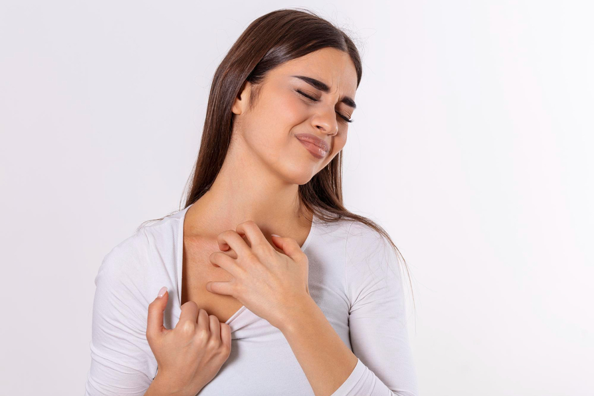 freepik_eczema_25y