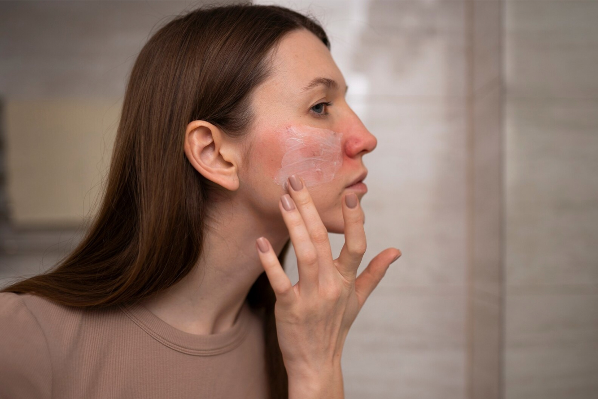 freepik_rosacea_25