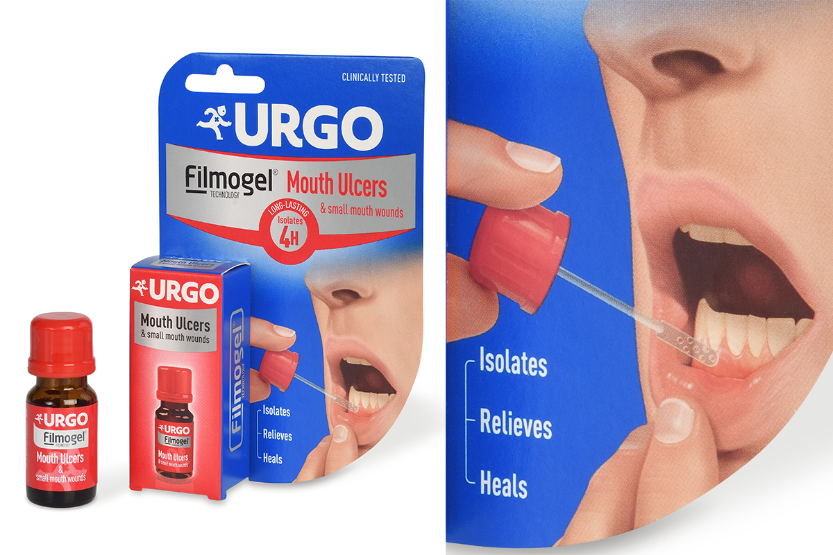 s_urgo_mouth_ulcers