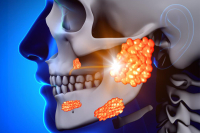 Mumps: Ako ho rozpoznať, koho najčastejšie postihuje a aká je najlepšia prevencia?