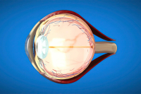 Nepodceňujte sivý zákal. Môže vás pripraviť o samostatnosť