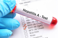 Hepatitída A nie je len choroba špinavých rúk