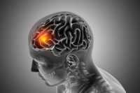 Viete, aké sú varovné príznaky náhlej cievnej mozgovej príhody?